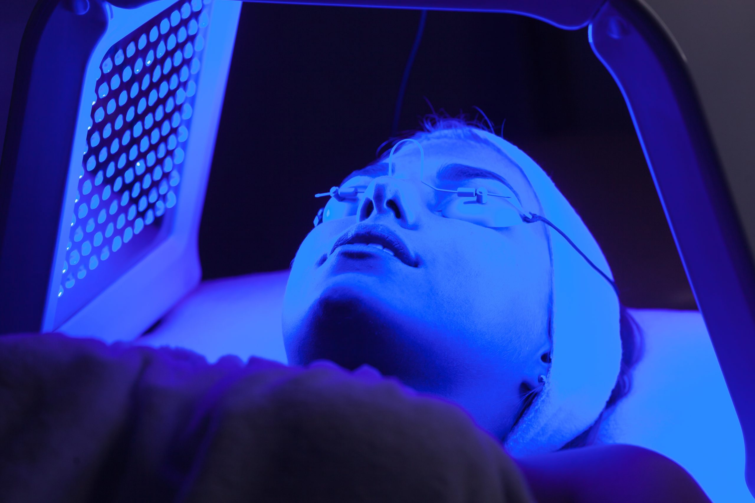 blue light therapy acne treatment philadelphia studio