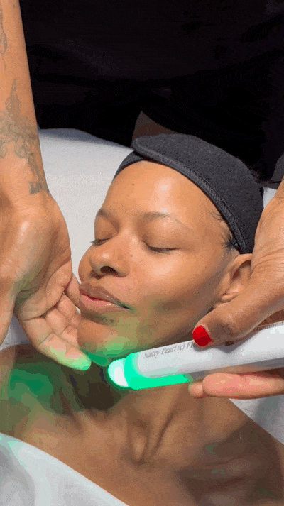 Le Fix Facial Anti-Aging ONLY available at Viviane Aires Skin Wellness
