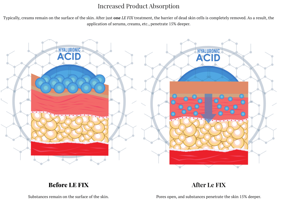 Product penetration chart from Le Fix at Viviane Aires Skin Wellness Facial Studio Philadelphia