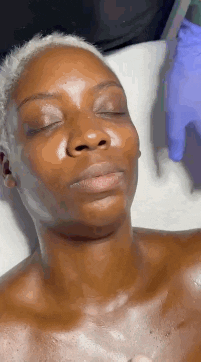 Buccal Massage Philadelphia Sculptural & Lifting Facial