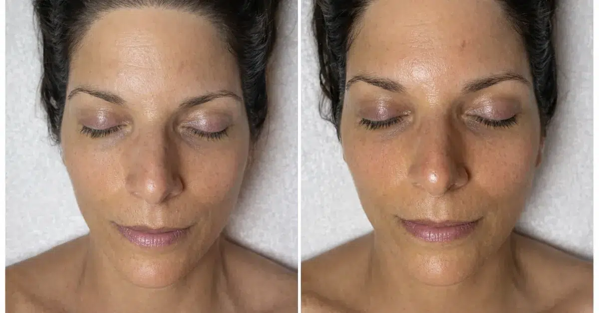 Aging skin focus program with licensed esthetician