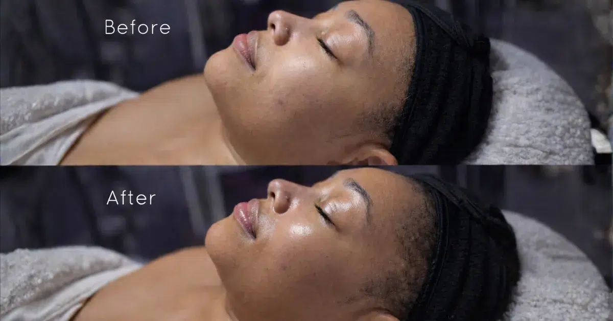 client receiving professional facial in philadelphia studio