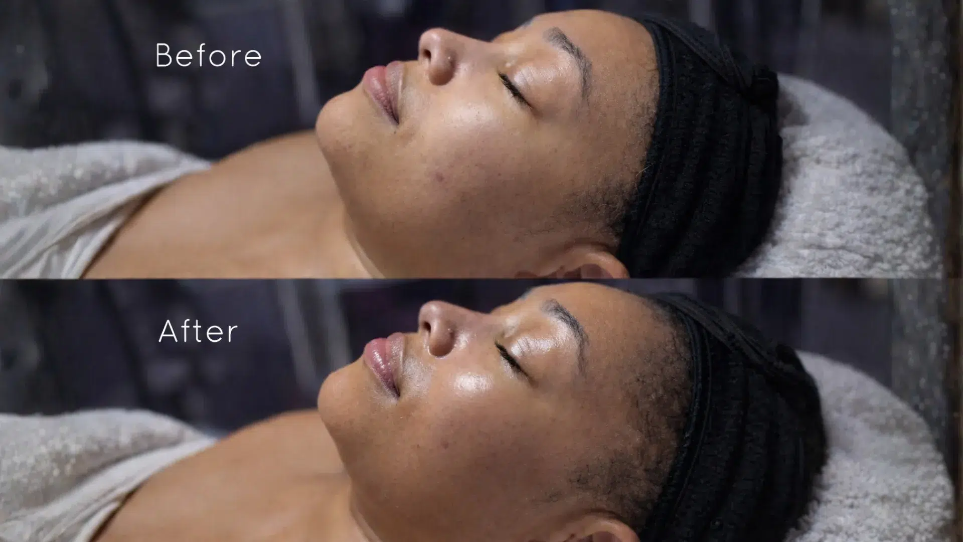 deep cleansing facial treatment philadelphia skincare studio