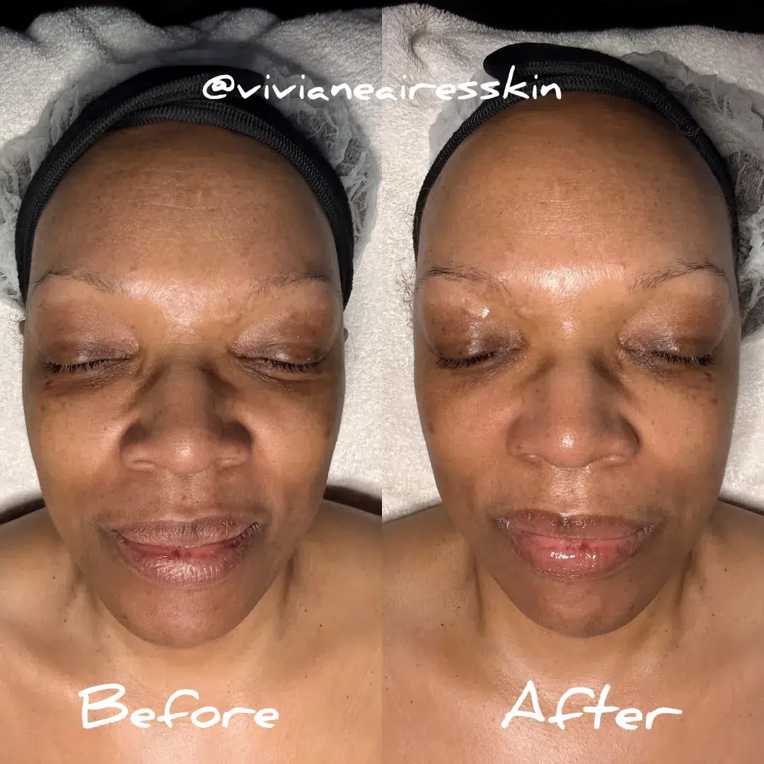 DiamondLift facial for smooth glowing skin